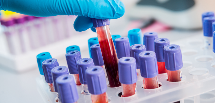 Generic photograph of blood tests in vials in a laboratory