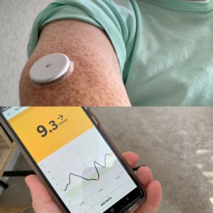 Two images merged, top image of top of person's arm with white plastic circle attached. Bottom image a mobile phone showing blood sugar levels