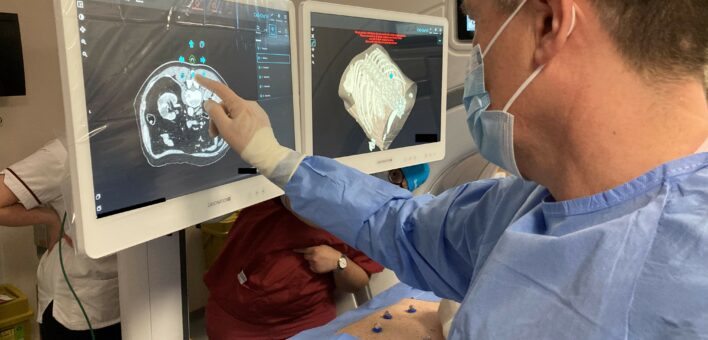 A surgeon points to a 3D image of a tumour on a screen.