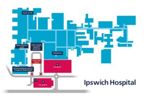 A map graphic of Ipswich Hospital
