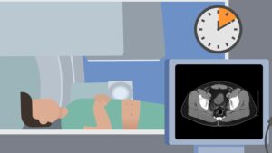 graphic illustration of a patient on a hospital bed with a scanning screen in view and a clock